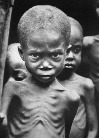 Starving child in Biafra